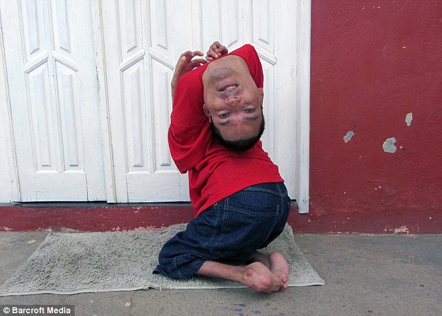 man with upside down head