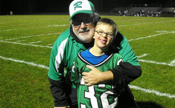 boy with down syndrome scores TD