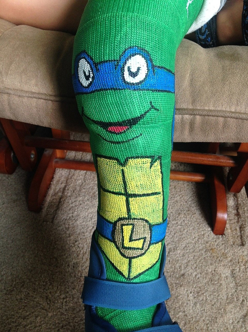 ninja turtle leg cast