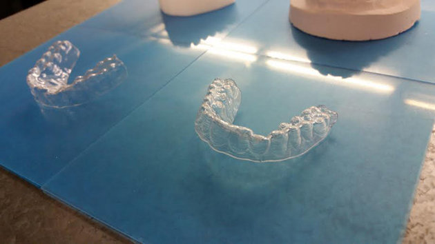 student makes braces for 60