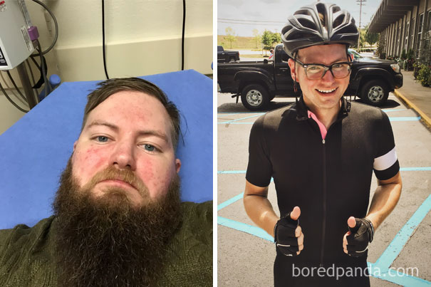 before and after getting sober