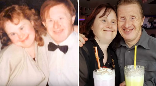 down syndrome couple 22 years