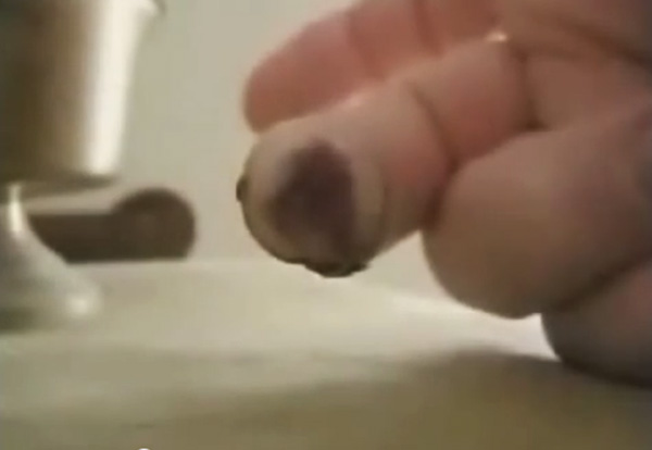 severed finger pigs bladder