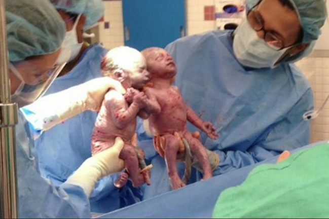 babies born holding hands