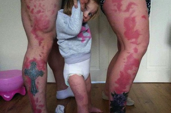 parents get leg tattoos of daughters birthmark