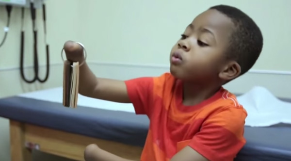 boy gets double hand transplant