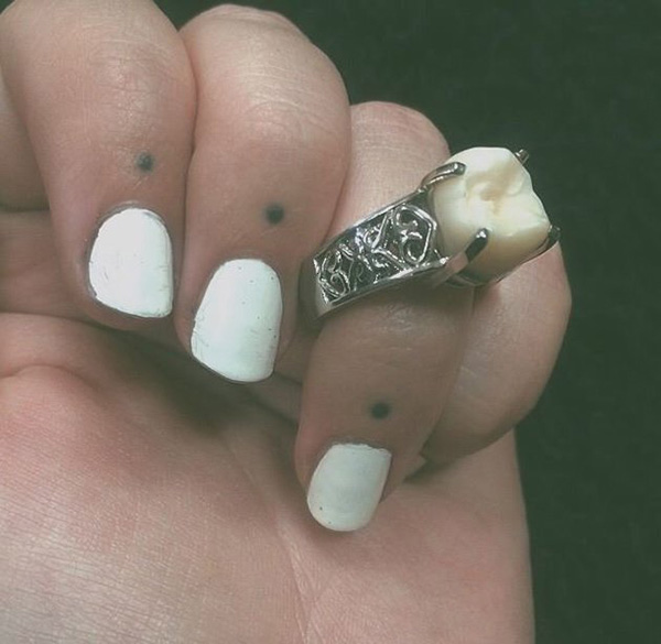 tooth engagement ring