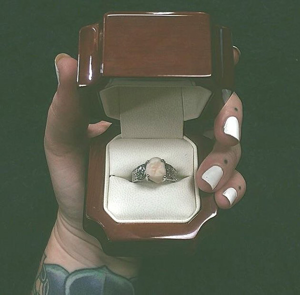 tooth engagement ring