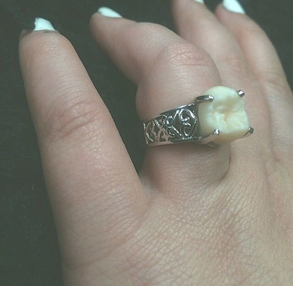 tooth engagement ring