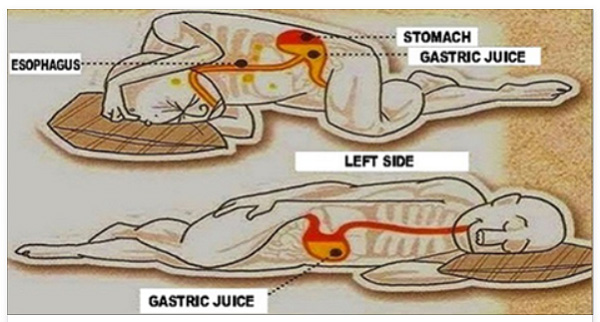 why you should sleep on your left side