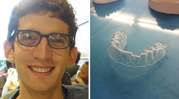 This College Student's 3DPrinted Braces Cost Him 60, And