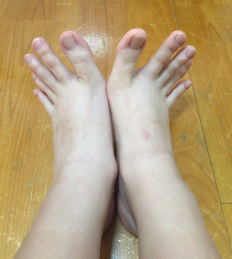 Finger toes