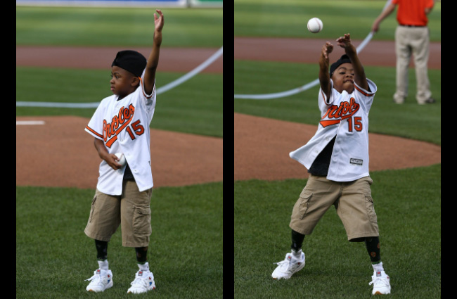 boy double hands transplant throws first pitch Orioles