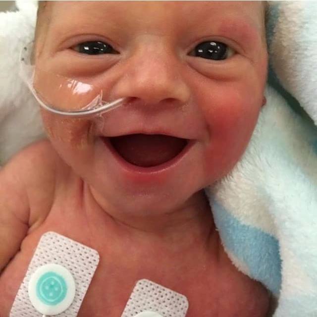 smiling happy preemie baby inspires