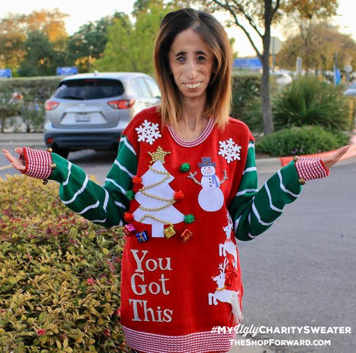 Lizzie Velasquez