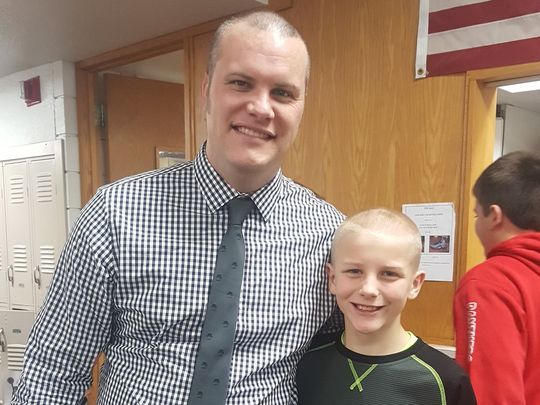 principal shaves head for bald student