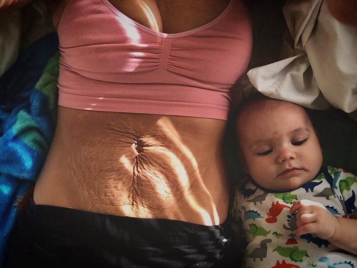 mom viral post about stretch marks and postpartum body