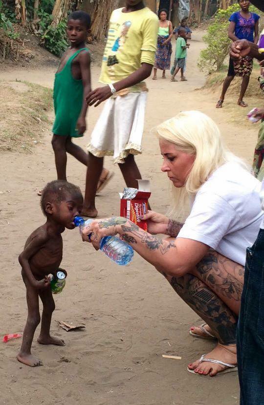 Nigerian witch boy Hope before and after