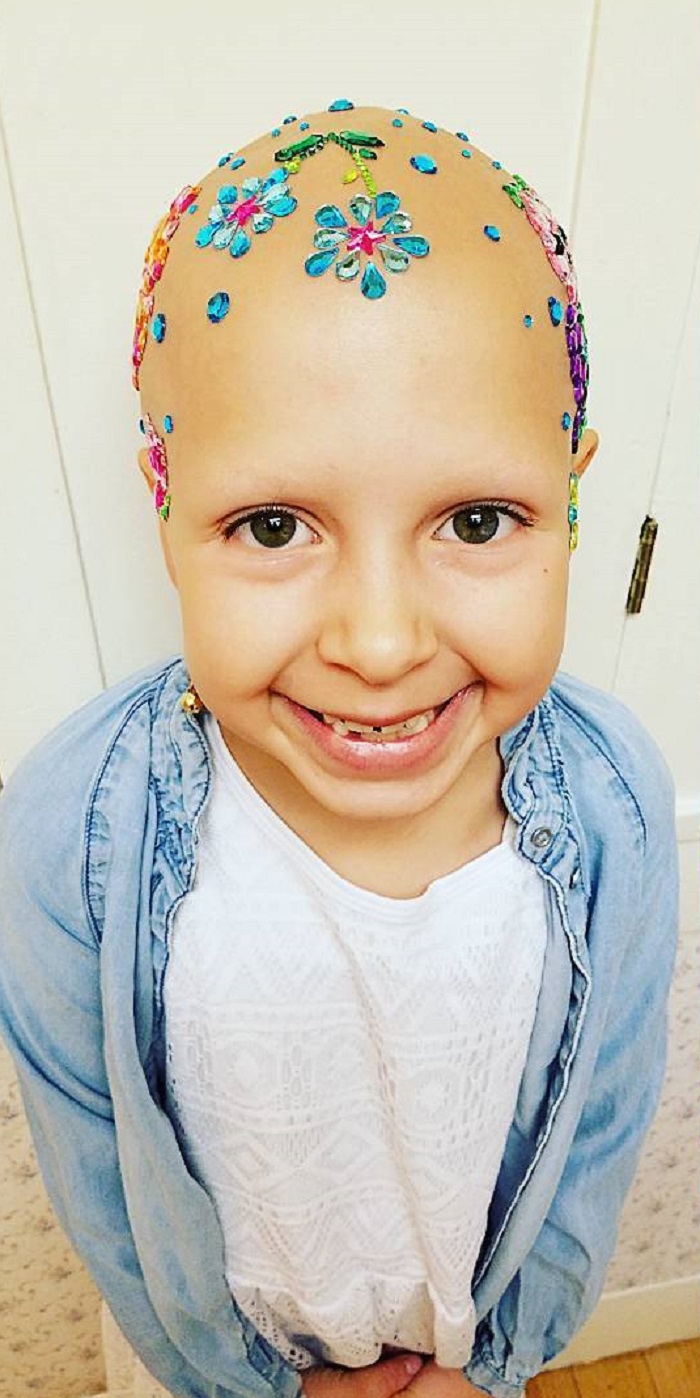 Mom Of Bald Daughter Comes Up With Brilliant Idea For Crazy Hair Day