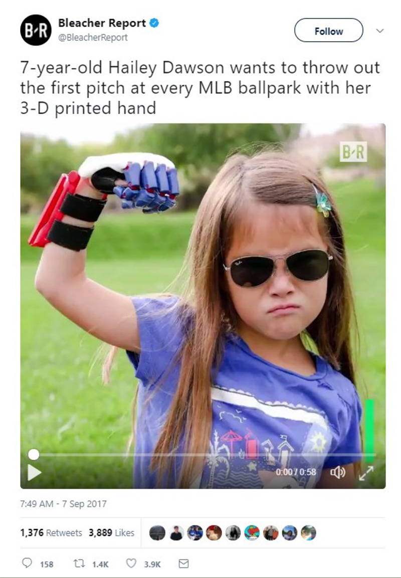 Sports Website Posts Video Of Girl With 3-D Printed Hand. The Responses Will Make Your Day Sports Website Posts Video Of Girl With 3-D Printed Hand. The Responses Will Make Your Day