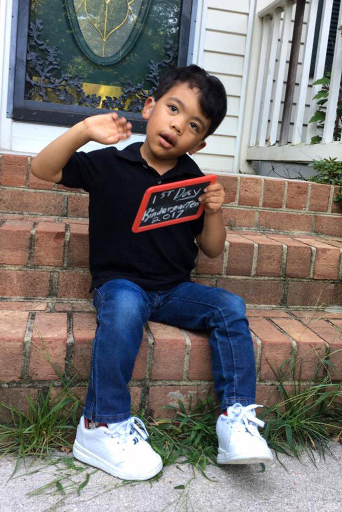 Determined 5-Year-Old Overcomes 22 Brain Surgeries To Make It To His First Day Of School Determined 5-Year-Old Overcomes 22 Brain Surgeries To Make It To His First Day Of School