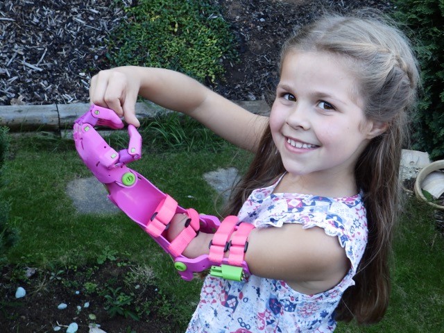 man makes prosthetic limbs for kids free shed