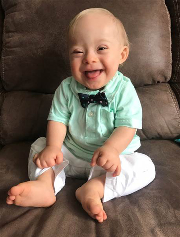 mom of gerber baby down syndrome