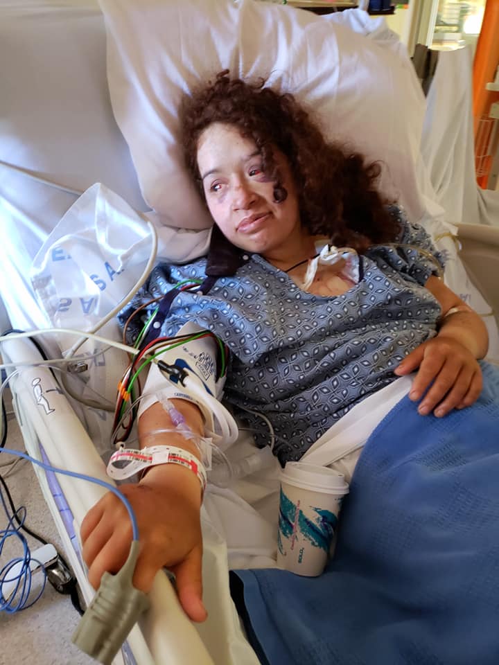 woman missing for a week after crash tells incredible survival story