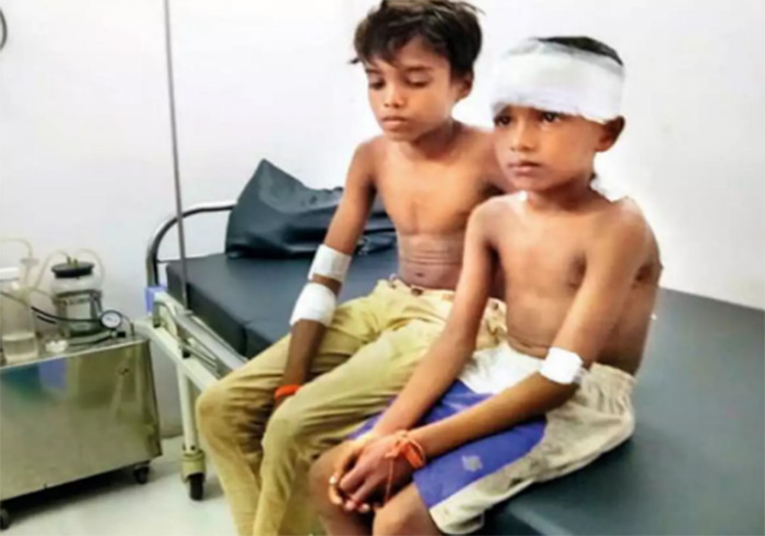 boy fights off leopard to save brother