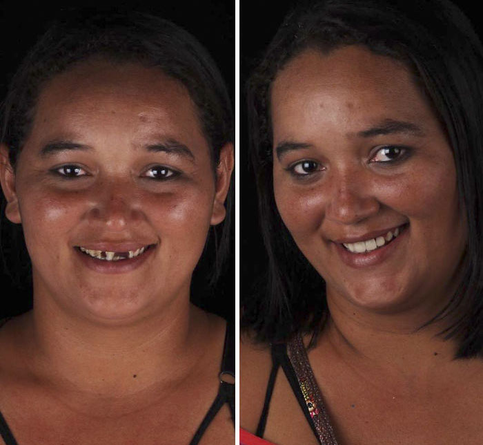 brazilian dentist fixes smiles free