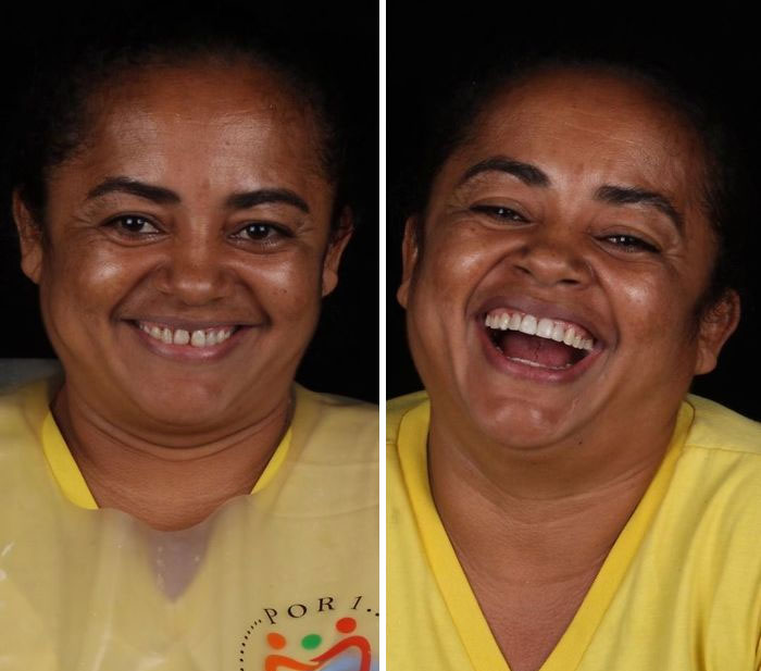 brazilian dentist fixes smiles free