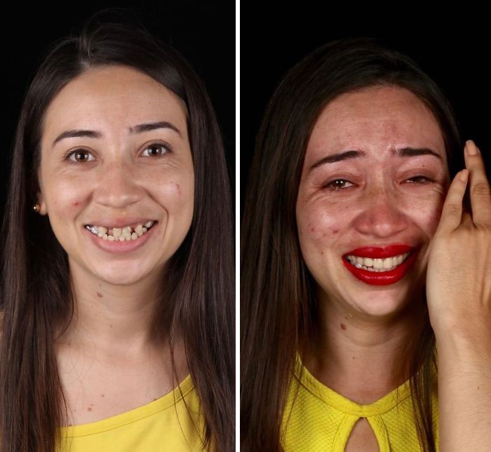 brazilian dentist fixes smiles free