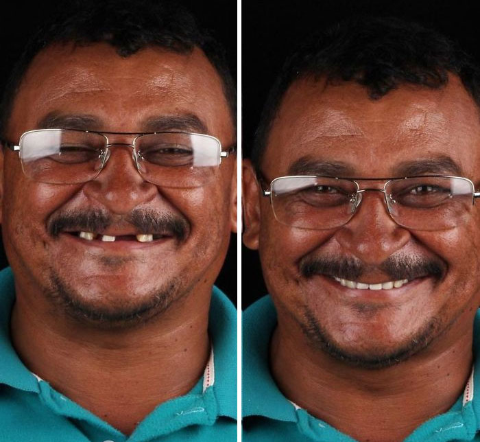 brazilian dentist fixes smiles free