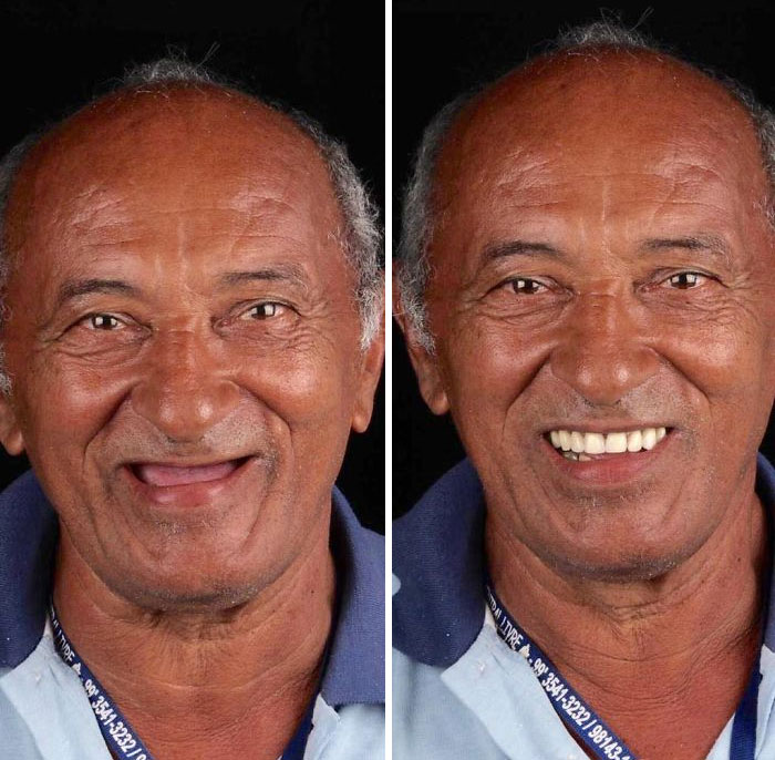 brazilian dentist fixes smiles free