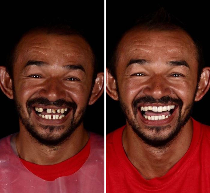 brazilian dentist fixes smiles free