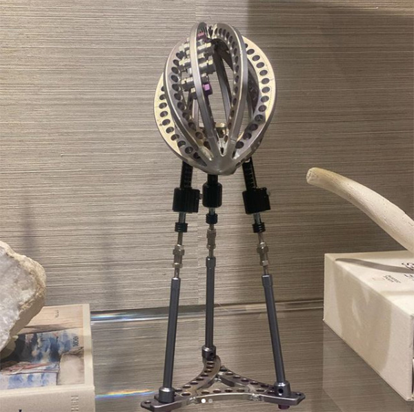 Alex Smith wife leg brace trophy