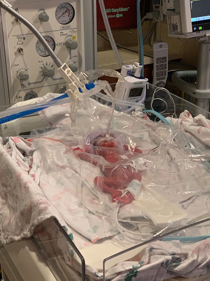 doctor saves preemie texas storm