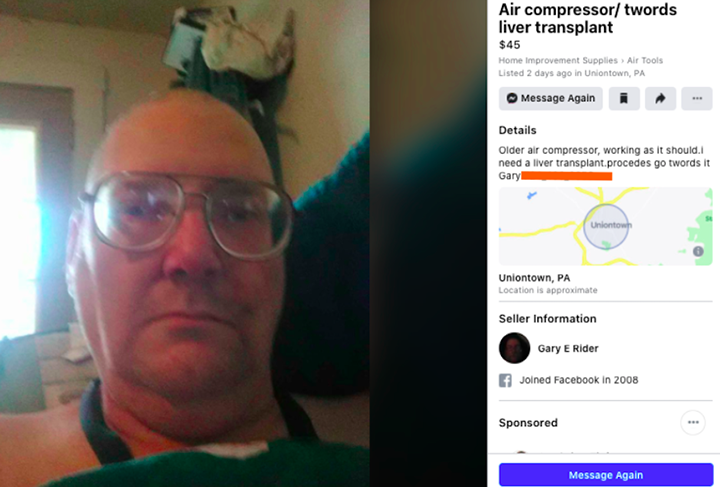 boomer facebook group liver transplant
