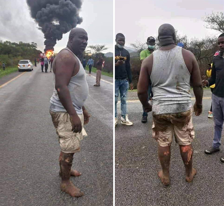 man in Zimbabwe pulls 8 people from burning bus