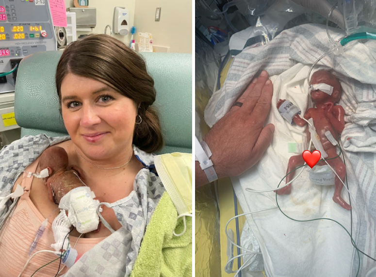 premature baby new record Nash